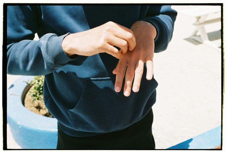 Struggling With Skin Irritation? You’re Not Alone — Here’s What Helps